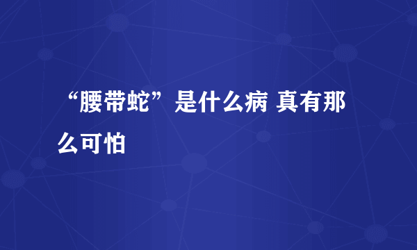 “腰带蛇”是什么病 真有那么可怕