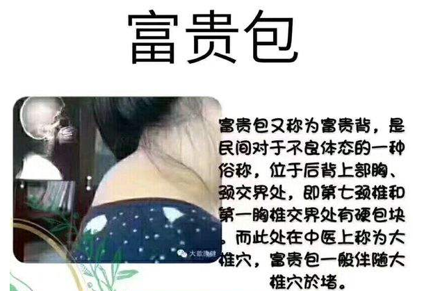 富贵包怎么消除？