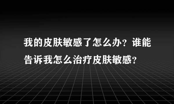 我的皮肤敏感了怎么办？谁能告诉我怎么治疗皮肤敏感？