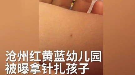 沧州红黄蓝再曝针扎虐童，针扎惩罚会是红黄蓝默许的吗？