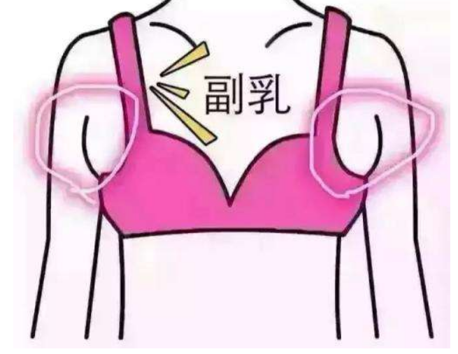 副乳对身体有什么危害？