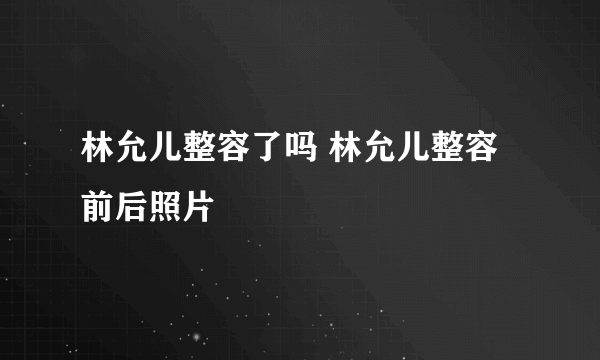 林允儿整容了吗 林允儿整容前后照片