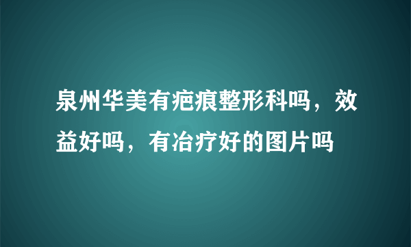 泉州华美有疤痕整形科吗，效益好吗，有冶疗好的图片吗