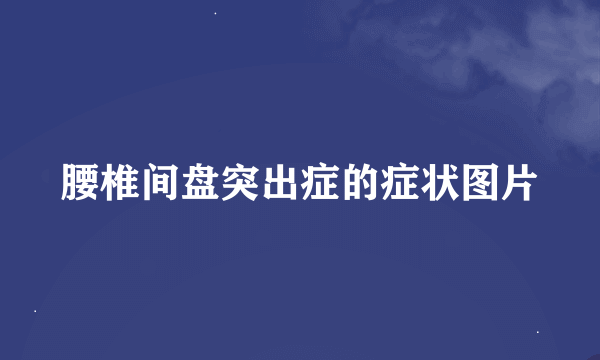 腰椎间盘突出症的症状图片