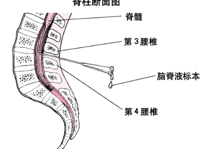 脊髓节段与椎骨的对应关系