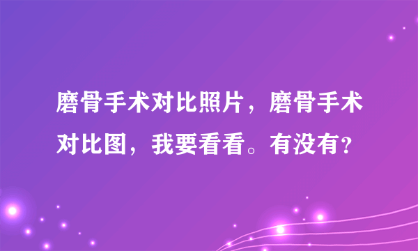 磨骨手术对比照片，磨骨手术对比图，我要看看。有没有？