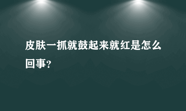 皮肤一抓就鼓起来就红是怎么回事？